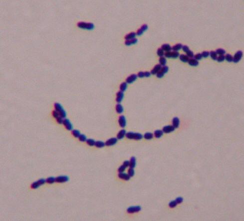 Streptococcus pyogens