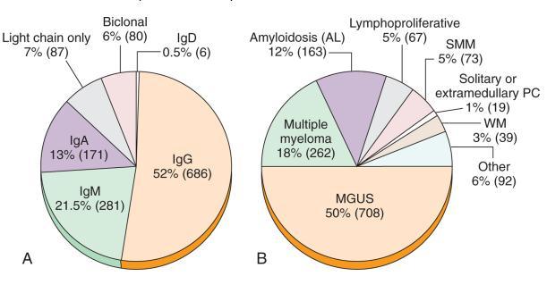 Monoclonal gammopathy. A, Distribution of serum monoclonal proteins in 1311 patients seen at the Mayo Clinic during 2004.