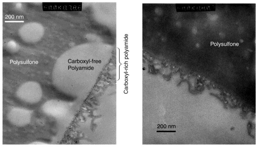 Figure 4 Cross-sectional TEM images of ESPA-1 samples: (a) stained with