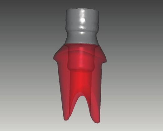 component for zirconia abutments.