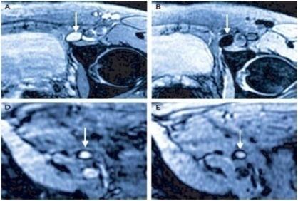 보유주요기술소개 MRI 조영제기술