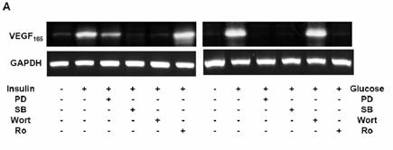 -Duk-Hee Kang : Insulin induces VEGF expression in HPMC - Figure 6. Effect of the inhibition of MAPK, PI3K or PKC on insulin- or high glucose-induced upregulation of VEGF mrna.