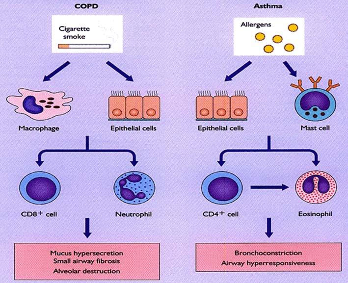 만성폐쇄성폐질환 (COPD) 과천식의감별 그림 3.