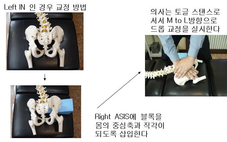 Full Spine Technique Protocol (Treatment Plan)