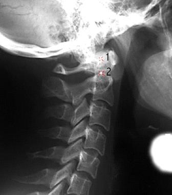 Full Spine Technique Protocol (Diagnosis) X-ray check