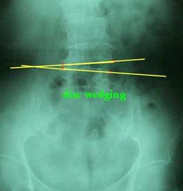 Full Spine Technique Protocol (Diagnosis) X-ray check (