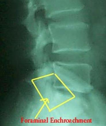 Full Spine Technique Protocol (Diagnosis) X-ray check ( 영상분석 ) 요추 (Lumbar)