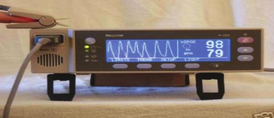 ECG (ElectroCardioGram) 심전도로환자의심장의건강상태를확인할수있다.