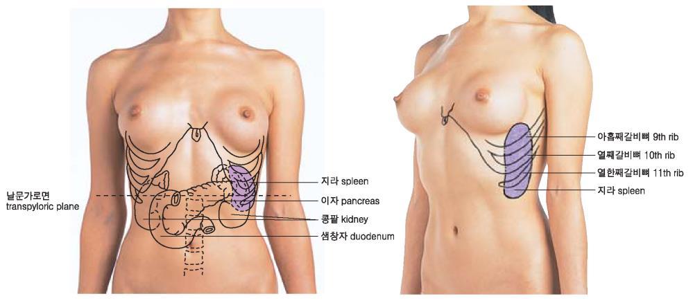Rupture of the spleen ( 지라파열, 갈비뼈골절, 교통사고, 폭행 ) - Although well protected by the 9th through 12th ribs, the spleen is the most frequently injured organ in the abdomen when severe blows on the left