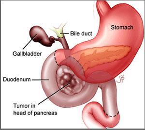 ) & 가슴내장신경 (thoracic splanchnic n.