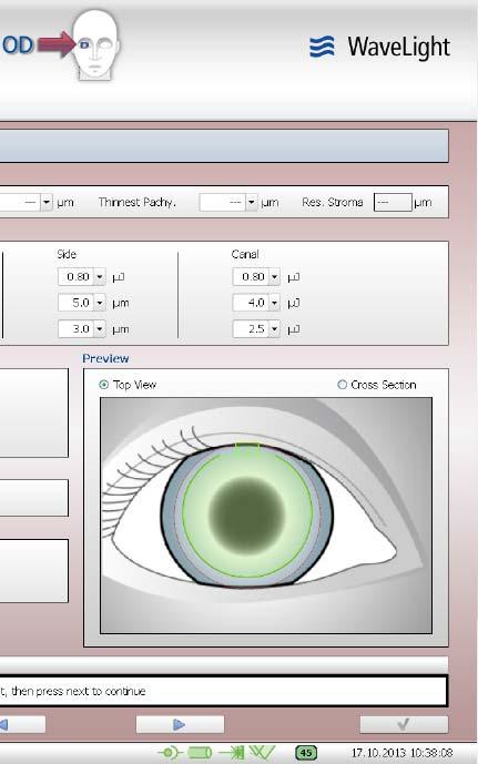 13) 직접치료 (Direct Treatment) (1) "Direct" 버튼을선택하여 Direct Treatment Window" 창을연다.