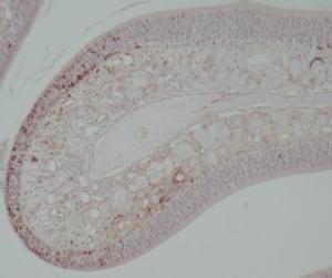 PCNApositive cells could be rarely found and localized mainly