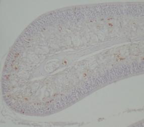 The PCNA-positive cells were found mainly in the superficial