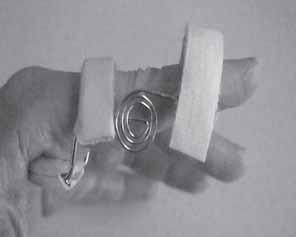 ) 수근관절에대한보조기 - Opponens orthosis with wrist control attachment - Volar wrist hand stabilizer(resting pan splint) - Dorsal