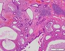 glands lined by normal