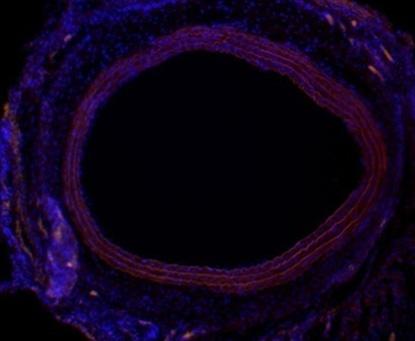 In Mok Jung, et al:differentiated MDSCs Attenuate IH