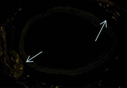 MDSCs infected with lenti-hcmv- GFP were delivered