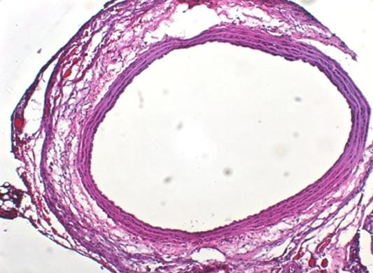 minimally observed in both celltreated (A) and control group (B) at 1 week.