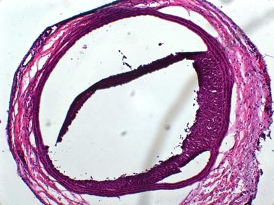 (7) 내피세포는혈관활성물질인 prostacyclin (PGI2) 과 nitric oxide (NO) 를분비하여혈소판의활성, 유착및응집을억제하는기능이있다.