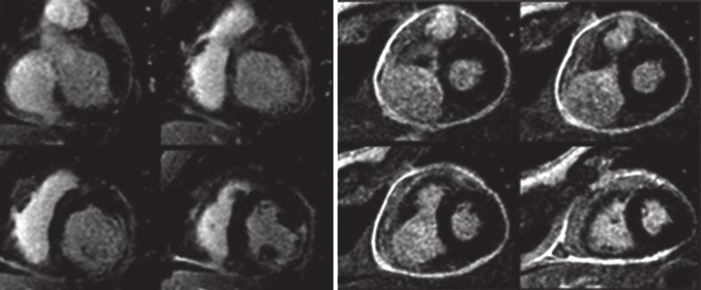 토막강좌 토막강좌 <<< Figure 5.