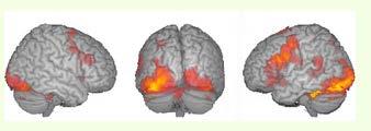 뇌의기능을살펴보는방법 Brain damage > abnormal behavior : 필요조건입증 ( 충분조건은미진 )