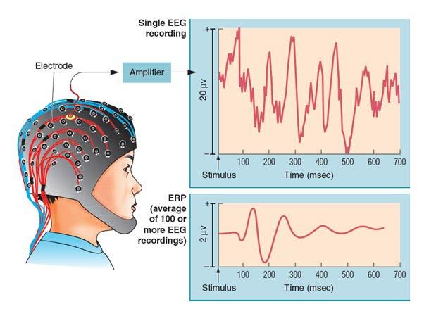 뇌의기능을살펴보는방법 ERPs (Event-related potentials 사건관련전위 ) 사건 (