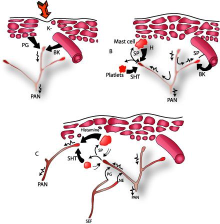 NSAIDs 1) Inhibition of PG synthesis 2) Inhibit cyclo-oxygenase effect on platelet 3) Effect on leukocyte