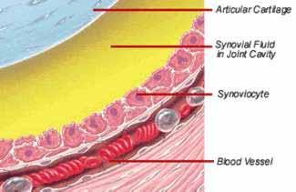 Synovial fluid: Clear, Jt : 0.