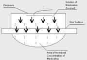 [Degenerative Arthritis] 1. General consideration A. Asymmetric non-inflammatory Ds without systeminc component B. Three type 1) Primary a.