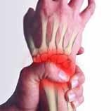 Rheumatoid hand 1) Wrist a.