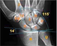 migration Distal row: dorsal migration d.