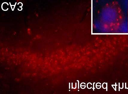 Oxidative stress in hippocampus after kainate treatment.