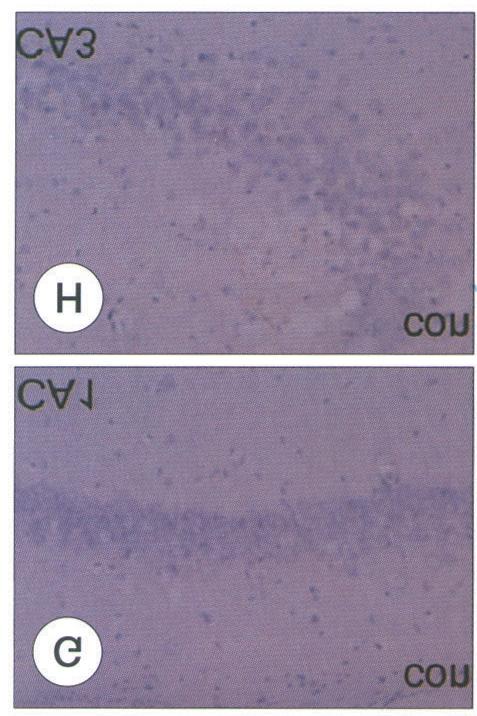 signals (the oxidized HEt signal indicates red A-F, original magnification