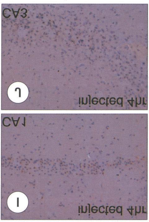 HEt signals in injected (E, F) hippocampus compared with the control (A, B)