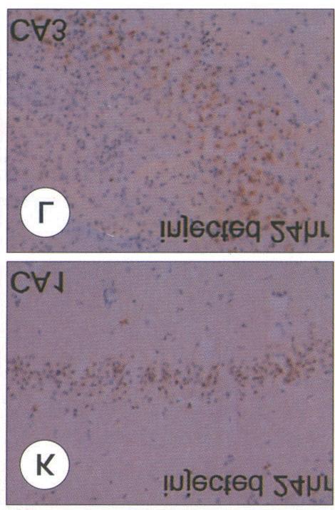 Inserts in D and F showed red granular pattern of oxidized HEt signals,