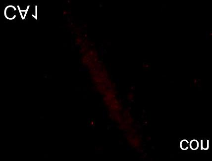 Cresyl violet staining and EEG recording after kainate treatment.