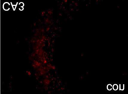 40). B Depth EEG recording during status epilepticus induced by kainate.