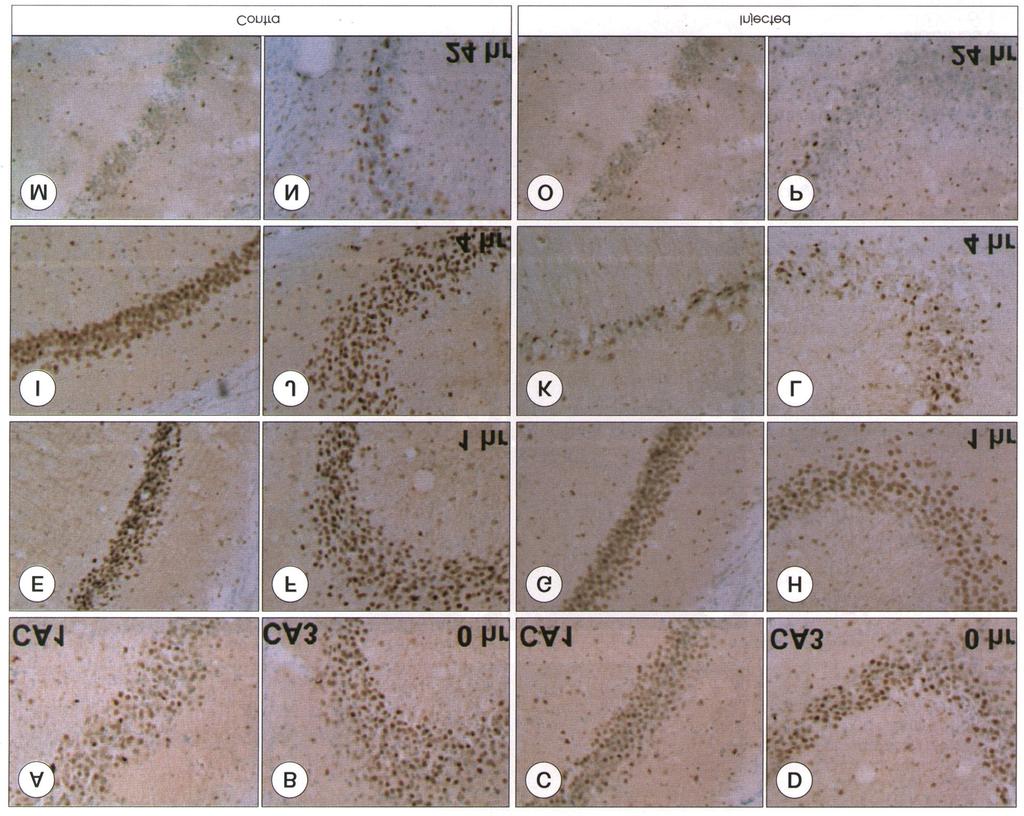 간질모델에서의 DNA 복구효소 해 주었으며, ANOVA(Post Hoc Tests)를 이용하여 통계 소체 염색이 약하였다. 또한 kainate 주입 후, 간질 중첩 처리하였고, p<0.05를 유의한 것으로 판정하였다. 현상이 나타나는 것을 확인하기 위해서 뇌파를 분석하였 다.