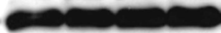 APE expression was shown as 37-kDa and was significantly decreased in the kainite-injected hippocampus 4 hr and 24 hr