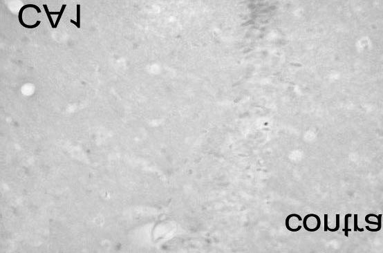 간질모델에서의 DNA 복구효소 A B C D E F Figure 5. TUNEL staining and double staining of APE/TUNEL 24 hr after kainate treatment.