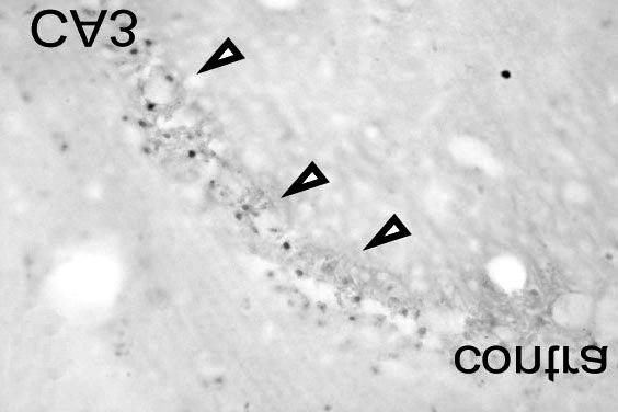 TUNEL-positive cells showed in CA3 (B original magnification 400) of contralateral hippocampus after kainate injection.