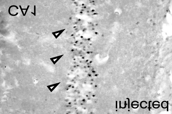 In double staining of APE/TUNEL, APE positive cells did not show TUNEL staining (E original magnification 400).