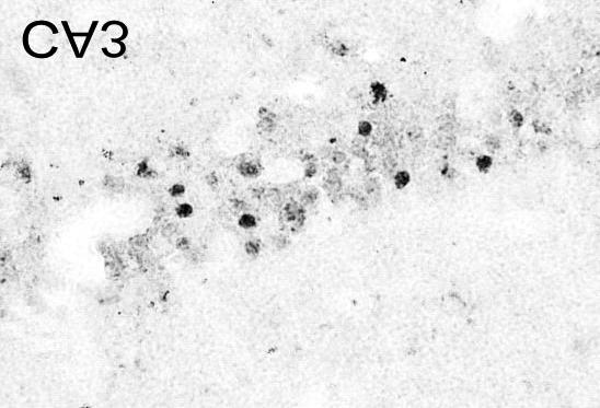 Kainate 색 형광을 띠는 ethidine과 기타 소량의 기타 산화물로 산 주입 4시간 뒤에 in situ HEt 방법으로 확인한 결과 산화 화된다.