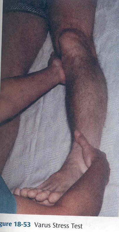 근골격계 : advanced technique Varus stress test 외측 collateral ligament 사정 바로누워서환측다리를약간 abduct 한다 오른손을환측무릎의안쪽에대고, 왼손을환측발목의외부에댄다