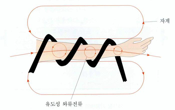 전자장가열법의열발생특징 코일의전자장에의해조직내에유도된와류전류