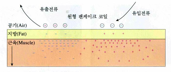 전자장가열법에사용하는전극의종류 - 코일전극