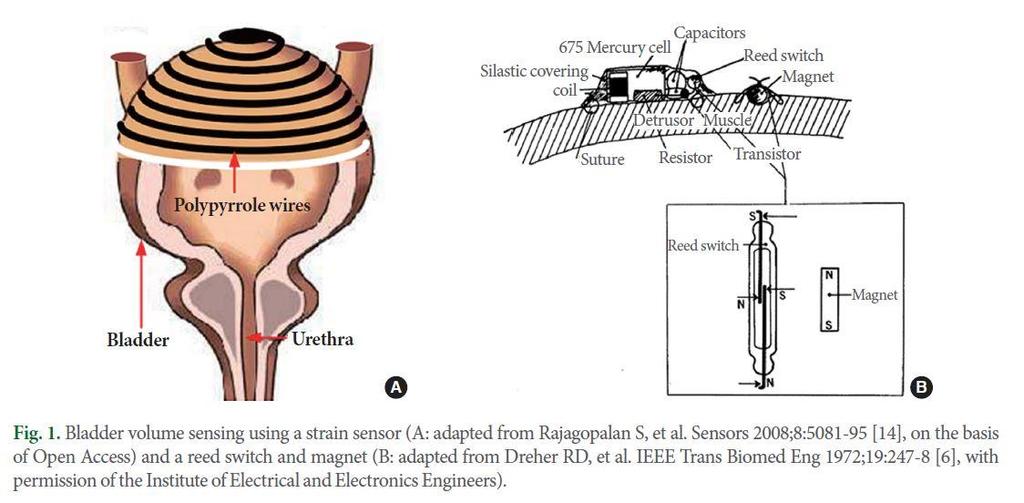 (A) Adapted from Rajagopalan S, et al. Sensors 2008;8:5081-95 [14], on the basis of Open Access.