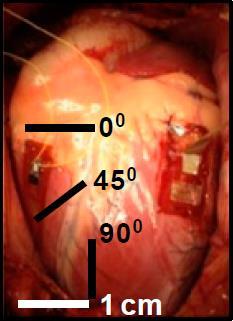 # 에너지하베스터부착위치 < 방향, 위치실험사진및결과 > > 심장위치에따른전압출력측정실험 : 우심방 (C),