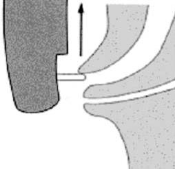 이러한차이는생체에서는담관과췌관사이의격벽이개구부방향으로끝까지나와있지만부검례에서는유두내로끌려들어가버리기때문이라고생각하고있다. 공통관형에서는조영초기에얕은삽관으로조영하면기본적으로담관과췌관이동시에조영된다. 췌관조영이과잉상태가되지않을정도로조영제를주입하여담관의주행을알수있으면그후카테터와담관의축을맞추어담관심부삽관하는것이좋다.