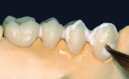 2 차 dentin 과 Incisal 소성 IPS InLine 전통적인축성 마무리한후수복물을완전히세척합니다. 흐르는물또는 Steam jet을사용해세척합니다.